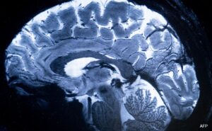 World’s Most Impressive X-ray Outputs first Pictures Of Human Cerebrum